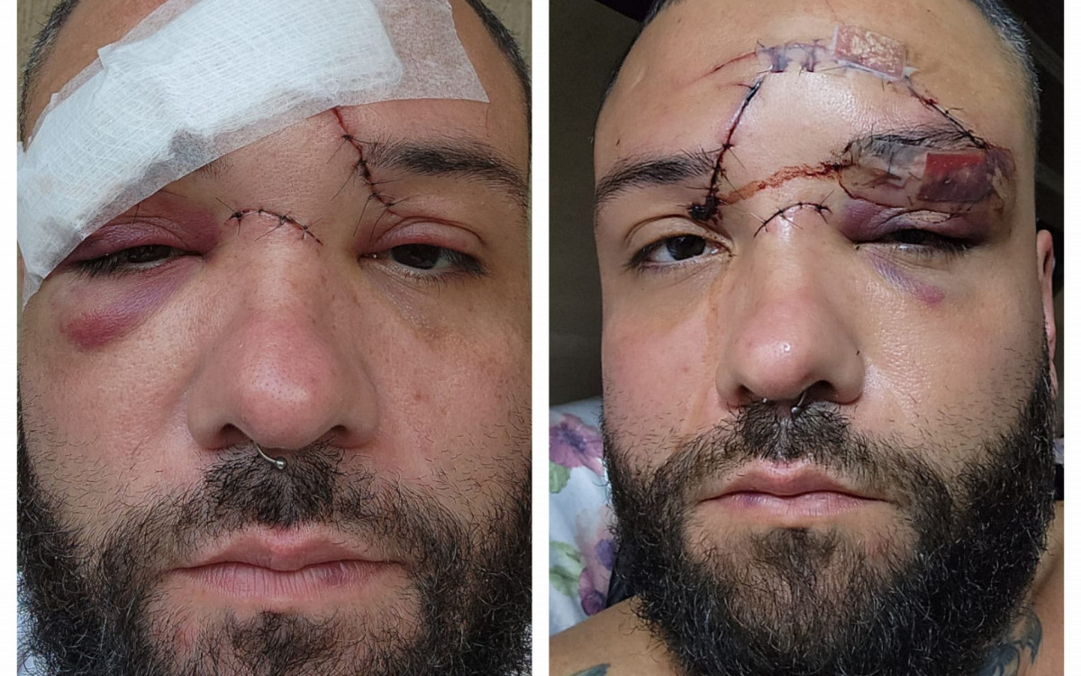 Polícia investiga agressão contra designer em Mesquita; vítima alega homofobia