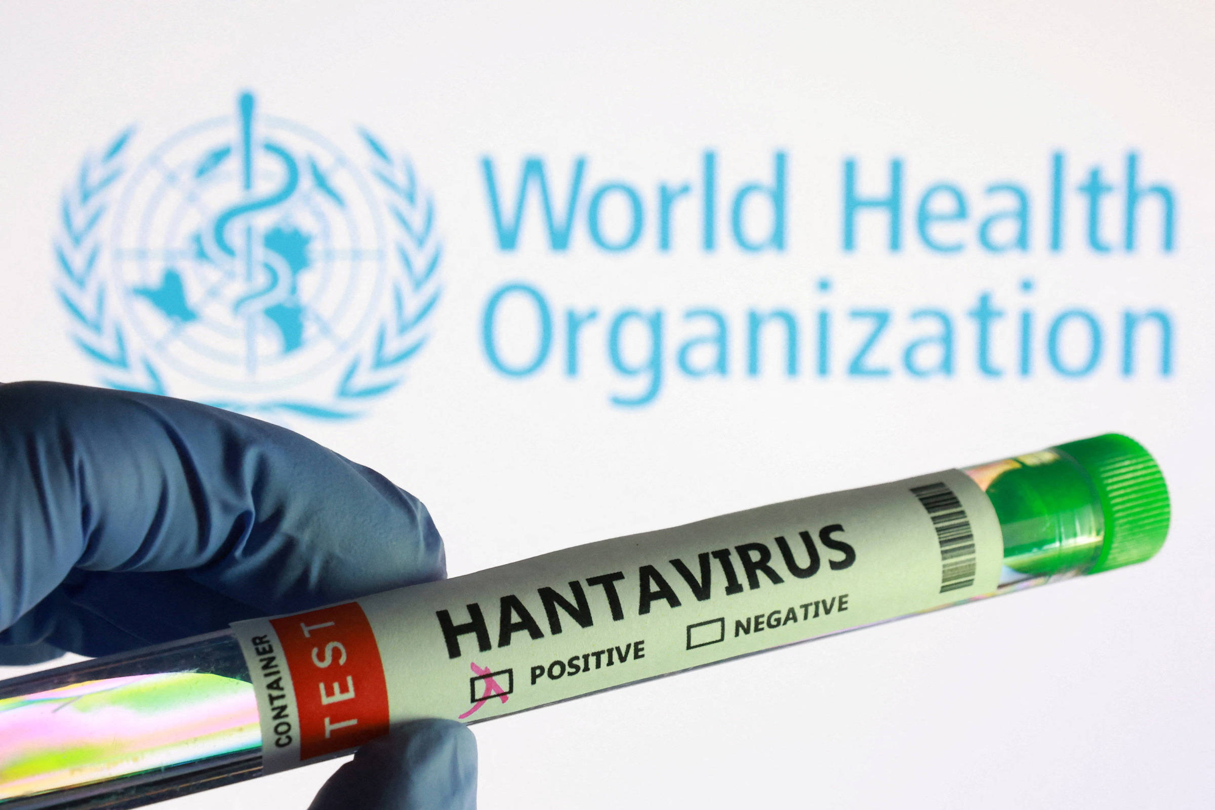 Hantavírus é altamente contagioso no início da doença, alerta OMS