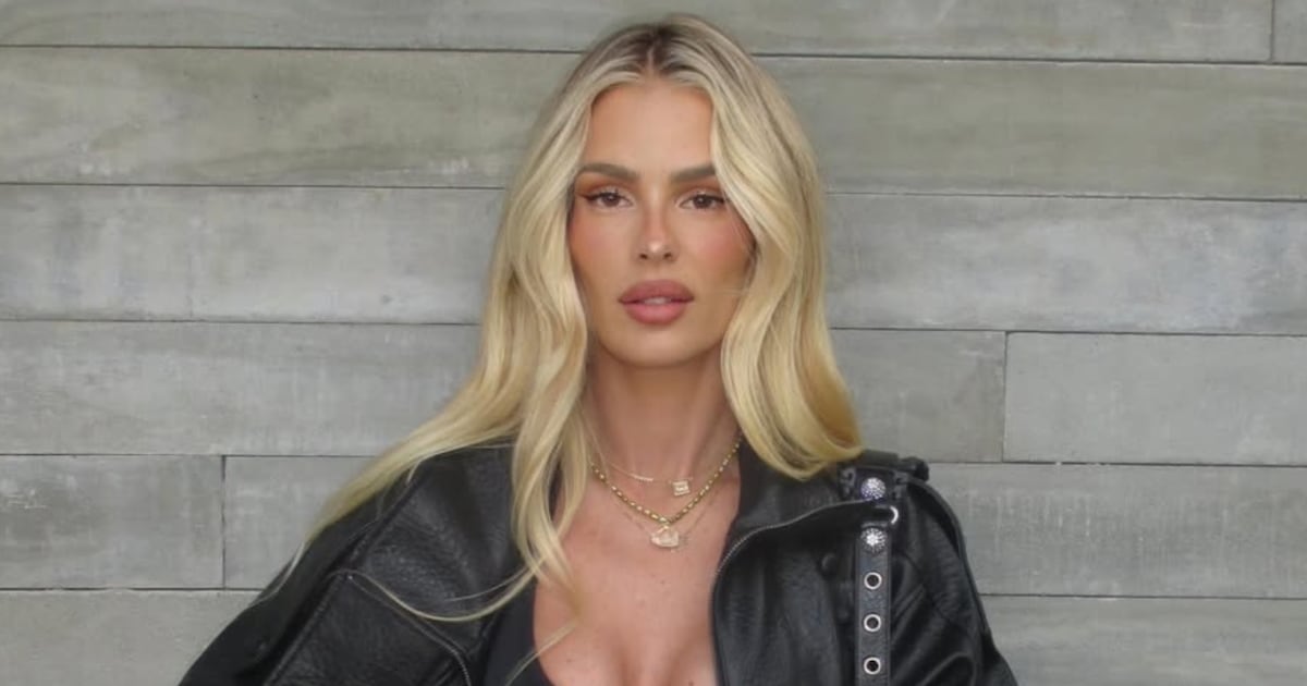 Yasmin Brunet revela que ‘morador de rua’ notou seu lipedema antes dos médicos