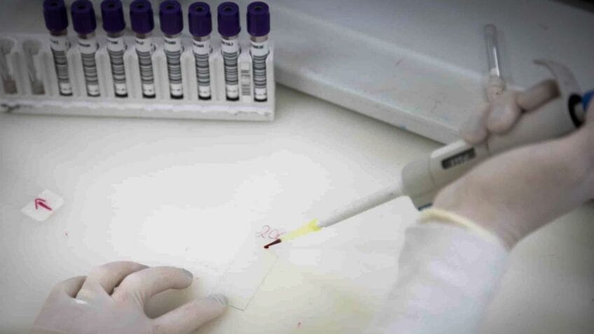 Paciente com suspeita de ebola em SP recebe diagnóstico de meningite em hospital.