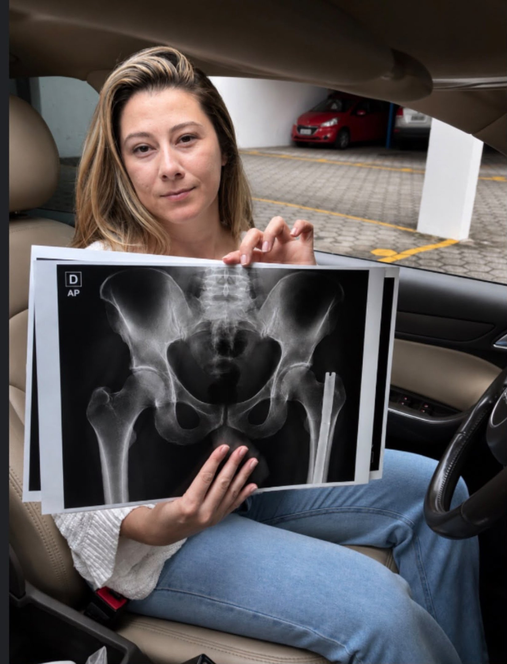 Influenciadora surpresa ao encontrar radiografias íntimas em caixa postal.